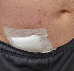 Golpe de faca atingiu a barriga do taxista (Foto: Alvaro Pegoraro)